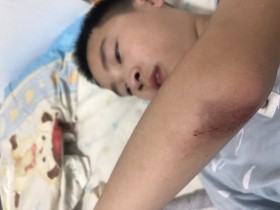 Yo哥挂了个小彩